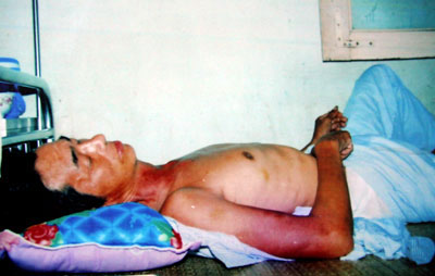 Một công dân ở Bắc Giang bất tỉnh khi làm việc với công an: Cần sớm có kết luận rõ ràng, khách quan