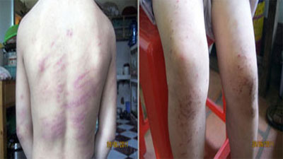 Lại phát hiện vụ hành hạ dã man bé gái 7 tuổi