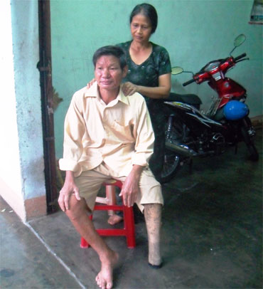 Đi bằng đôi chân… của vợ!