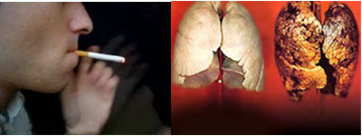 Hút thuốc lá khiến bệnh hen càng trầm trọng hơn