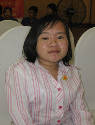 Cô bé tật nguyền vượt lên số phận