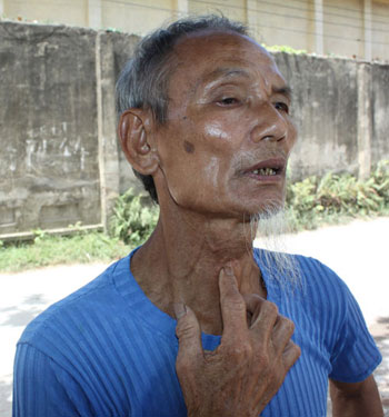 Chuyện diệt gian, tự cắt cổ, mổ bụng để đấu tranh của cựu tù Phú Quốc (kỳ 2)