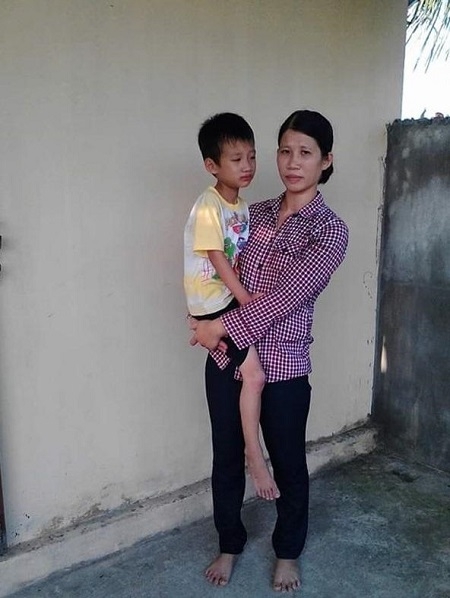 Cháu Quân mong được phẫu thuật