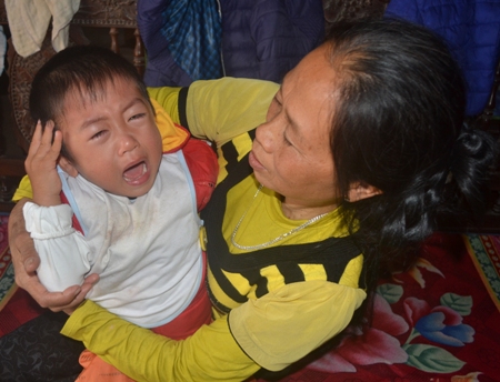 Bé trai 3 tuổi bị bệnh bại não co cứng