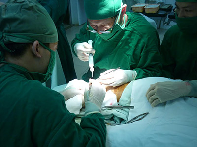 Nối thành công bàn chân bị đứt lìa với cẳng chân