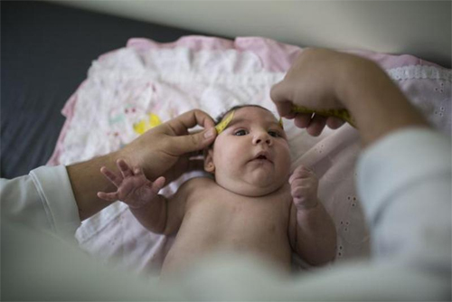 Brazil: WHO quá thận trọng về mối liên quan giữa virus Zika với bệnh đầu nhỏ 