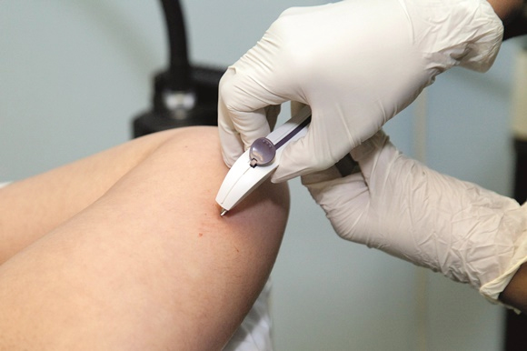 Thử nghiệm liệu pháp cấy ghép phòng ngừa HIV