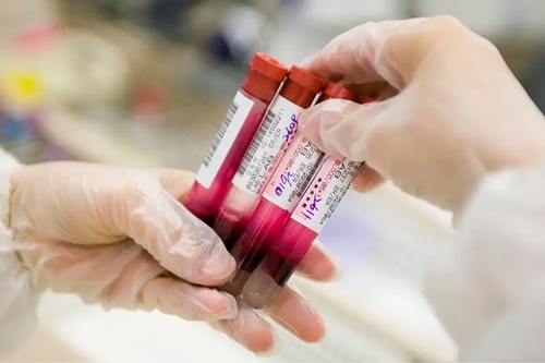 Xét nghiệm máu phát hiện hàng chục bệnh ung thư

