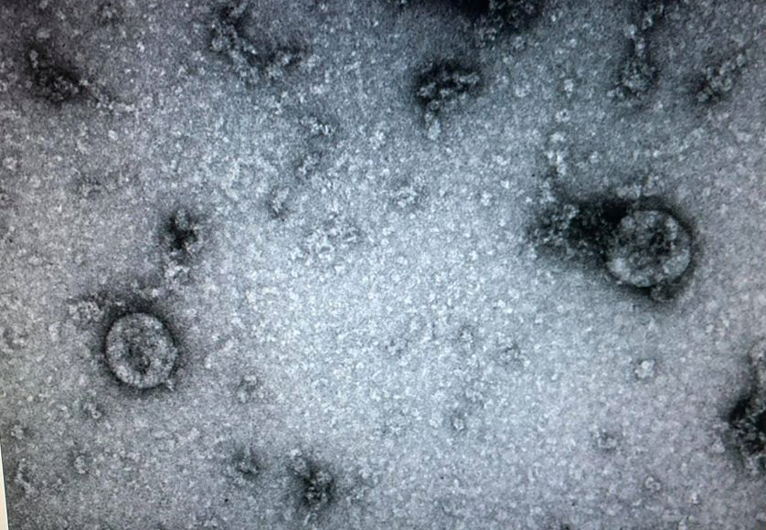 Việt Nam nuôi cấy và phân lập thành công virus corona chủng mới