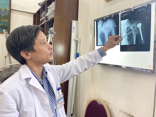 Bệnh viện Việt Đức thay khớp vai và khớp háng cho bệnh nhân bị ung thư phổi