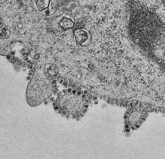 Virus Covid-19 có ở đâu trong môi trường xung quanh chúng ta?