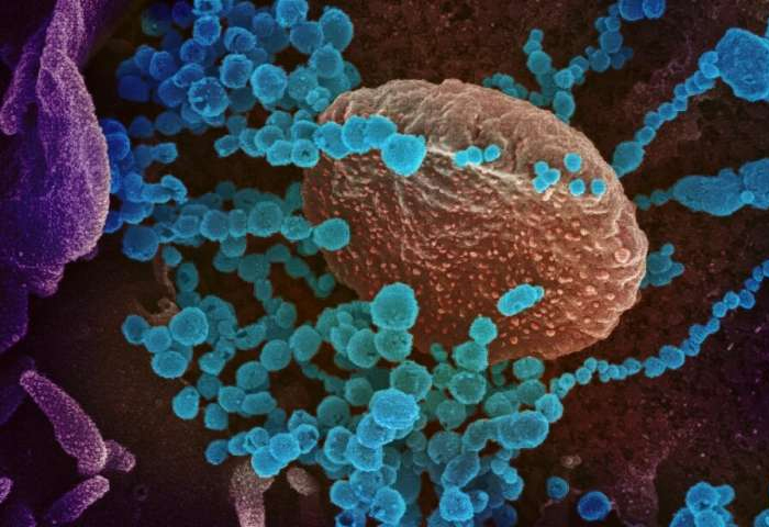 Lập bản đồ phản ứng miễn dịch với virus từ bệnh nhân Covid-19

