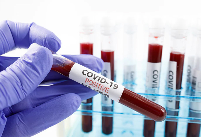 Nhóm máu có thể ảnh hưởng tới tỷ lệ mắc Covid-19

