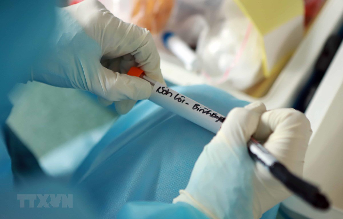 Lấy mẫu xét nghiệm đến 30 ngày với các trường hợp nhiễm Covid-19 đã xuất viện