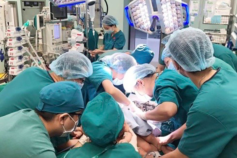 Thực hiện thành công ca phẫu thuật tách rời hai bé dính nhau