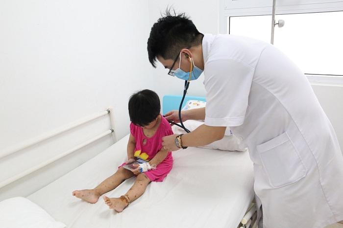 Không chủ quan với biến chứng của bệnh thủy đậu