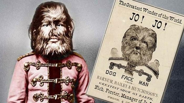 Chuyện về cậu bé “người sói” Nga từng chinh phục khắp nước Mỹ