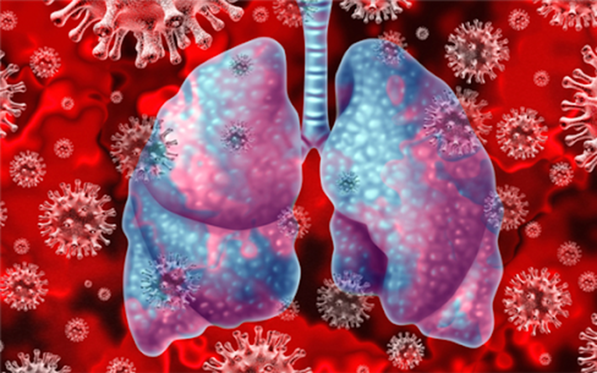 Hỏi – Đáp về Covid-19: Bão Cytokine ở bệnh nhân Covid-19 có nguy hiểm?