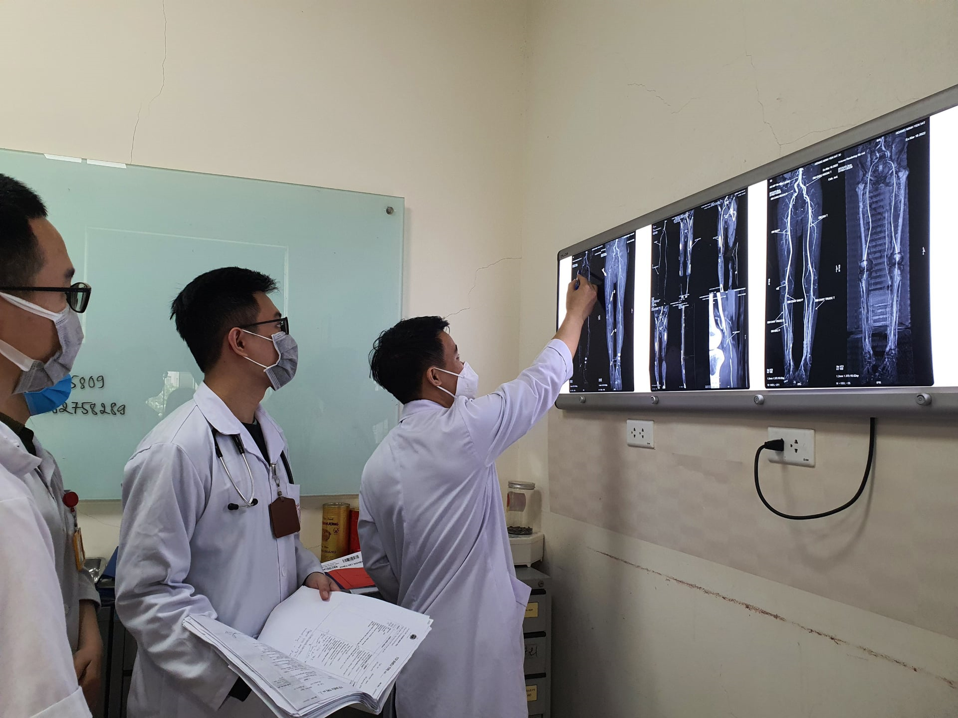 Một bệnh nhân thoát tàn phế vì được cấp cứu kịp thời