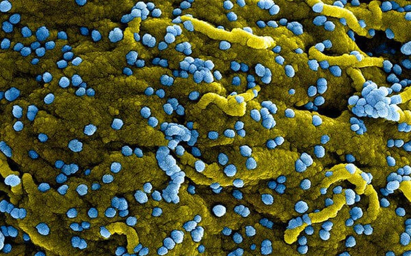 Virus Marburg (màu xanh lam), vừa sinh sôi và gắn trên bề mặt của các tế bào bị nhiễm bệnh (màu vàng). Ảnh: vtv.vn