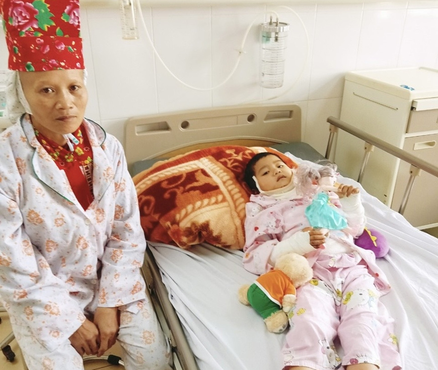 Cấp cứu thành công cho bệnh nhi 3 tuổi dân tộc Dao bị bỏng nặng