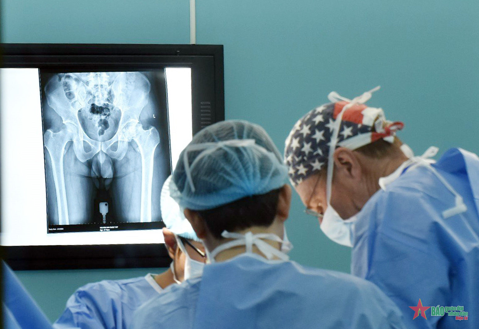 Phẫu thuật thay khớp háng miễn phí cho các bệnh nhân nghèo 