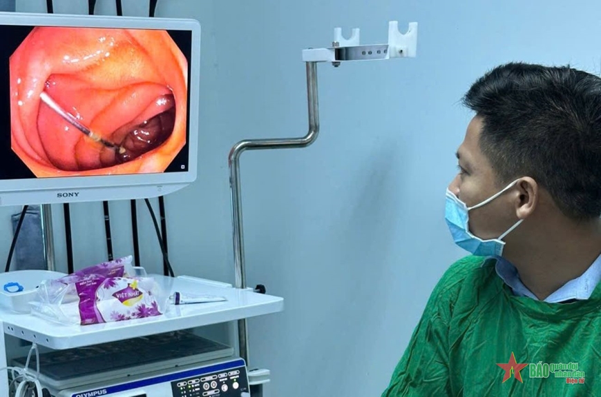 Bác sĩ Bệnh viện Quân y 87 gắp kim tiêm trong ống tiêu hóa của bệnh nhân