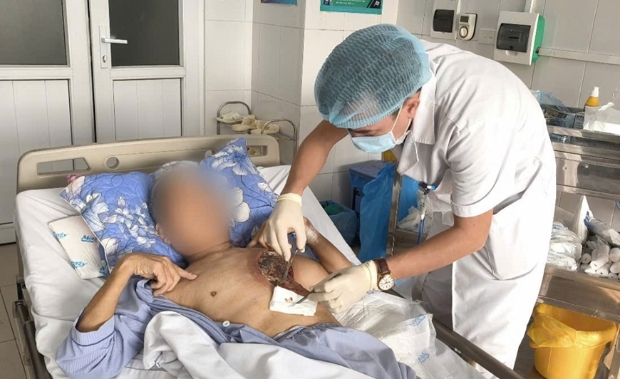 Hoại tử vùng ngực do nhiễm nấm hiếm gặp