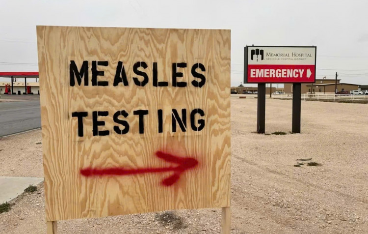 Mỹ ghi nhận ca tử vong đầu tiên do sởi sau gần một thập kỷ