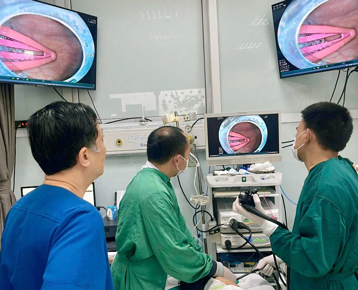 Gắp thành công kẹp tóc dài 5cm khỏi dạ dày bé gái 21 tháng tuổi