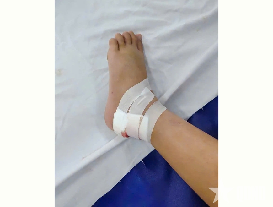 Cần Thơ: Cảnh báo nguy cơ rắn cắn trẻ nhỏ trong mùa nước nổi