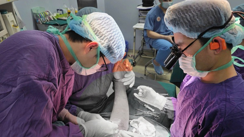 Nối thành công cho bệnh nhân đứt rời 1/3 trên cánh tay
