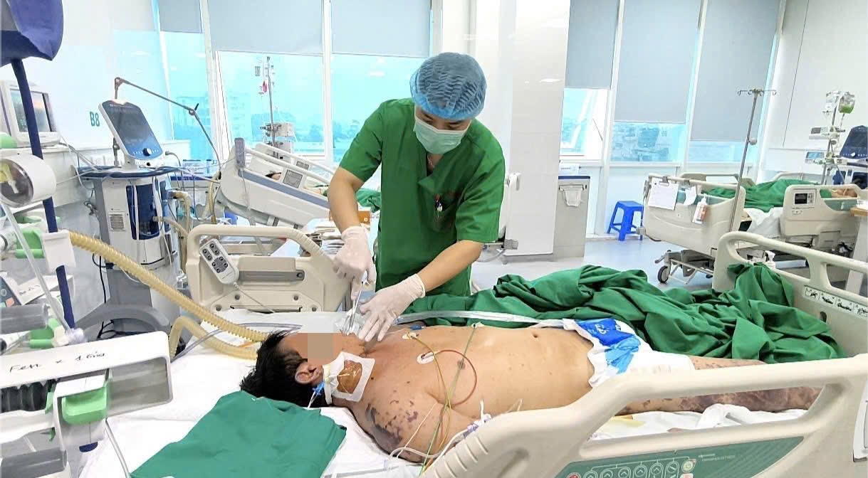 Nguy kịch vì vi khuẩn não mô cầu: Dễ nhầm lẫn với liên cầu khuẩn lợn