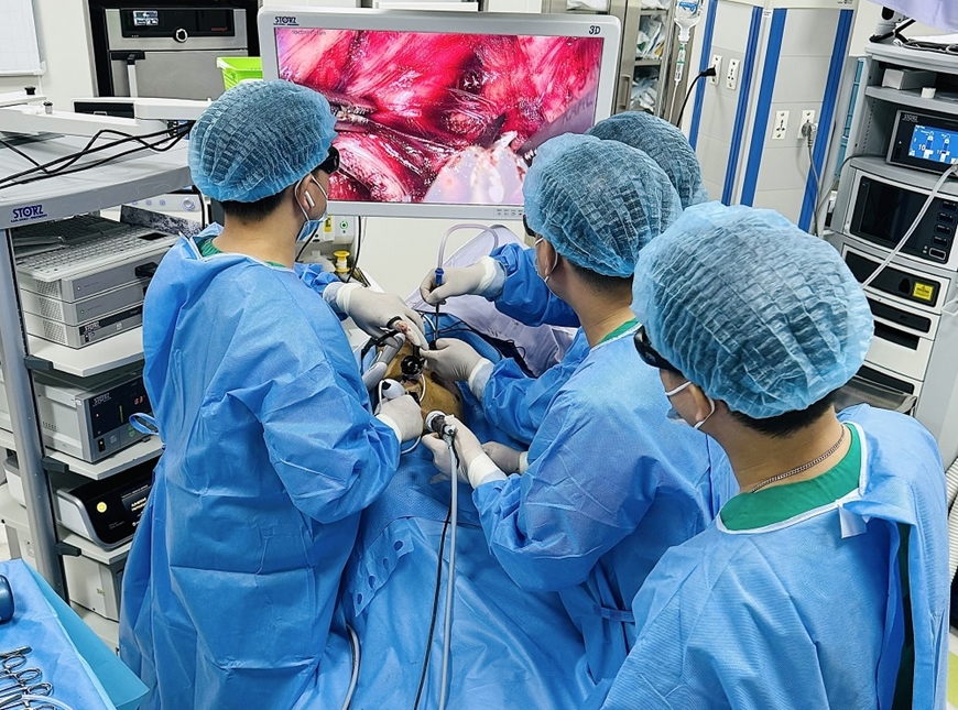 Bệnh viện K: Phẫu thuật th&agrave;nh c&ocirc;ng hai trường hợp ung thư thực quản phức tạp bằng phương ph&aacute;p mổ nội soi 3D