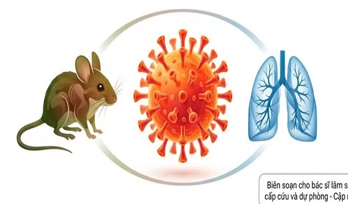 Bộ Y tế yêu cầu tăng cường giám sát virus Hanta tại cửa khẩu, cơ sở khám bệnh, chữa bệnh