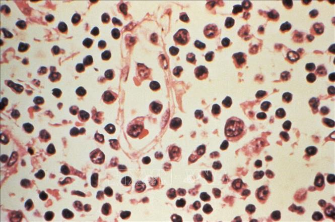 Virus Hanta: Chuyên gia khuyến nghị cách phòng tránh 