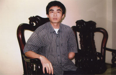 Anh nhận hy sinh cả bàn tay cơm áo