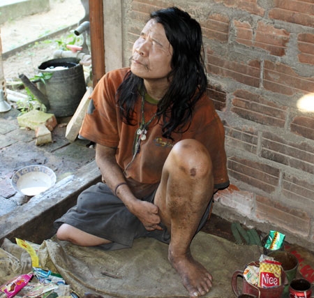 Ước tính mỗi năm nước ta có gần 4.000 người chết và bị thương do bom, mìn, vật nổ. Anh Võ Đức Quốc, 50 tuổi, xóm Phú Hạ, xã Bình Chương (huyện Bình Sơn, tỉnh Quảng Ngãi) là nạn nhân của vật nổ kể từ năm 1986, trong khi làm vườn. Hậu quả của vụ nổ khiến anh cụt chân phải, tay trái, mù mắt phải và bị thần kinh từ đó đến nay.