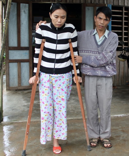 Tháng 11-2011, gia đình thuê xe chở đất về đổ nền sân. Trong khi san nền, chị Ngô Thị Mộng, nay 41 tuổi, ở thôn 5, xã Thủy Phù (huyện Hương Thủy, tỉnh Thừa Thiên-Huế) va phải mìn, dẫn đến cụt ống chân phải và bị thương chân trái.